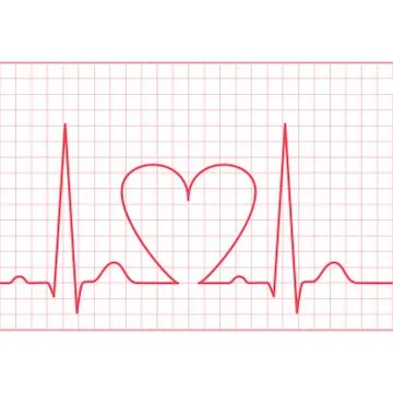 ECG - electrocardiogram feed Stock-Illustration