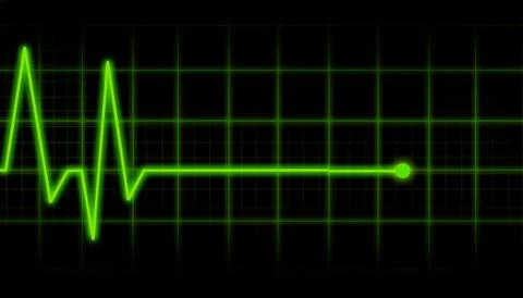 ECG Electrocardiogram イラスト素材