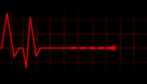 ECG Electrocardiogram. イラスト素材