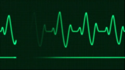 ECG Electrocardiogram Pulse Vidéo 2257579