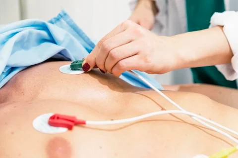 ECG electrodes on the patient Stock Photos
