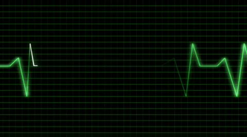 Ecg Stock Footage 540036