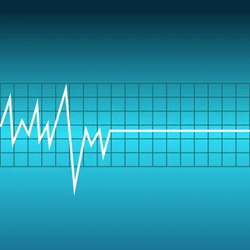 Ecg graph on blue background Stock Illustration