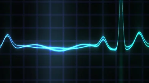 ECG graph with blue line on black background. Stock Footage 335512130