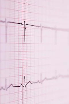 Ecg graph Stock Photos