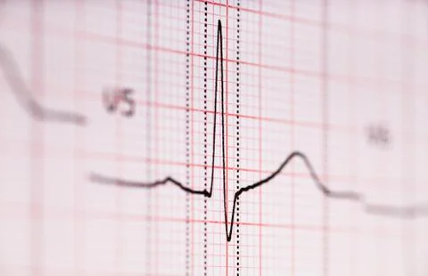 Ecg graph Foto stock