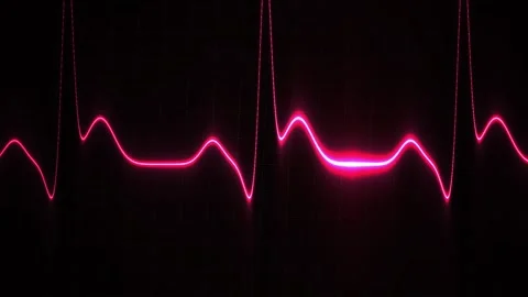 ECG graph with pink line. Stock Footage 335108303