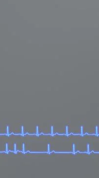 ECG graphs comparison of normal heart rhythm and arrhythmia Stock Photos