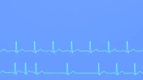 ECG graphs comparison of normal heart rhythm and arrhythmia Stock-Fotos