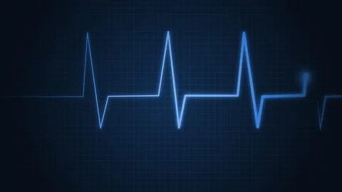 Ecg heart rhythm line on graph paper showing pulse spikes and flat line ani.. Stock Footage 336905112