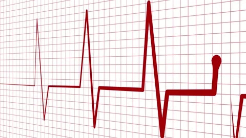 Ecg heart rhythm line on graph paper showing pulse spikes and flat line ani.. Stock Footage 336905129