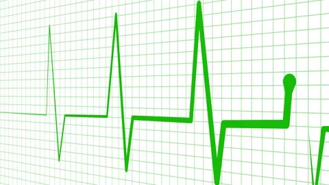 Ecg heart rhythm line on graph paper showing pulse spikes and flat line ani.. Stock Footage 336905139