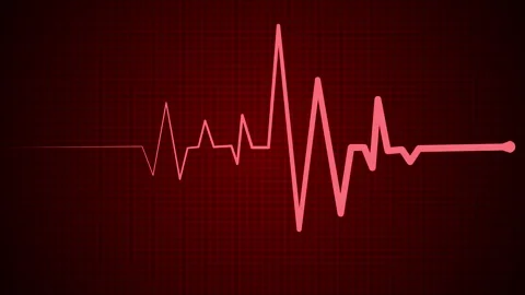 ECG Heartbeat Line on Grid Background, Electrocardiogram (ECG) line on a da.. Stock Footage 305165627