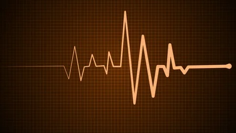 ECG Heartbeat Line on Grid Background, Electrocardiogram (ECG) line on a da.. Stock Footage 305165689