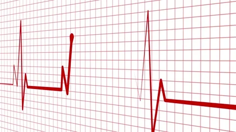 ECG Heartbeat Line on Grid Background, Medical Heartbeat ECG Animation Vidéo 310206099