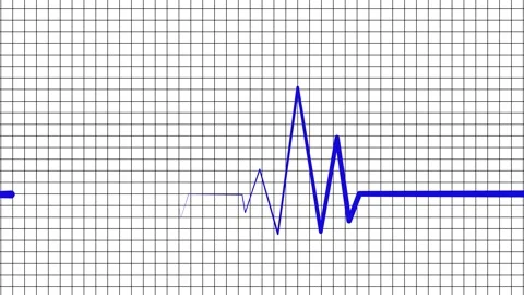 ECG Heartbeat Line on Grid Background, Medical Heartbeat ECG Animation Stock Footage 310206237