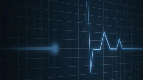 ECG Heartbeat Line on Grid Background, Electrocardiogram ECG Line Animation.. Video stock 310206461