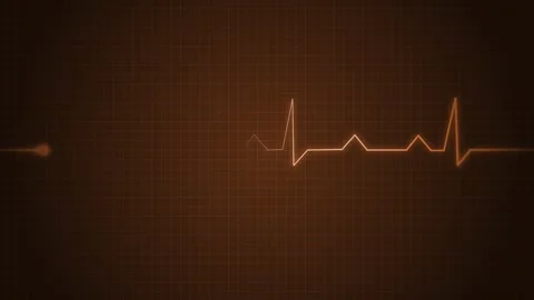 ECG Heartbeat Line on Grid Background Animated, Clean and Professional Hear.. 動画素材 310206593