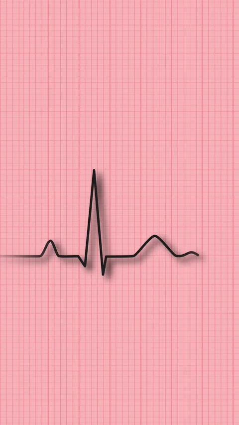 ECG heartbeat line loop animation on medical grid background vertical video Stock Footage 331745967