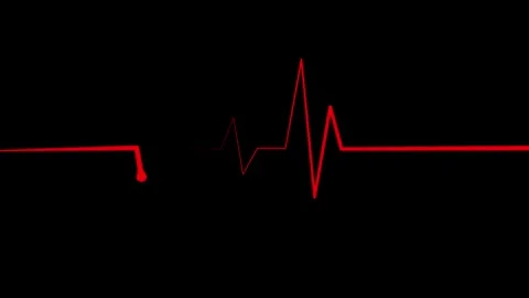 Ecg heartbeat line sharp pulse spike showing a medical monitor trace and a .. Stock Footage 337182665