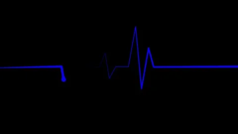 Ecg heartbeat line sharp pulse spike showing a medical monitor trace and a .. Stock Footage 337182674