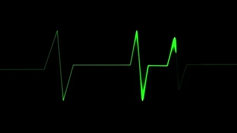 ECG Heartbeat Signal Pattern Stock Footage 332824418
