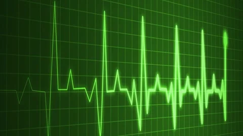 ECG Heartbeat Waveform Animated, Electrocardiogram Heartbeat Line Signal An.. Видео 309887189