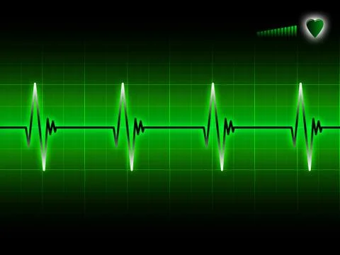 Ecg Stock Illustration