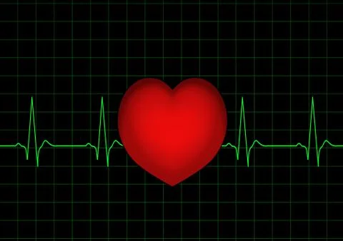 ECG Stock Illustration