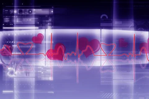 ECG Illustrazione stock