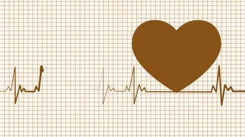 ECG Line Animation in Flat Minimal Medical Monitor Display for Motion Graphic Vidéo 316788507