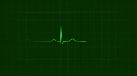 Ecg loop background Stock Footage 7549578