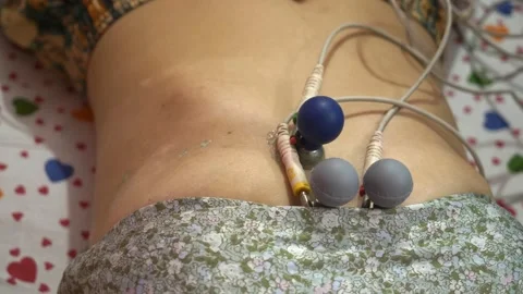 ECG machine electrodes attached to female patient's chest to record heart Stock Footage 295756595
