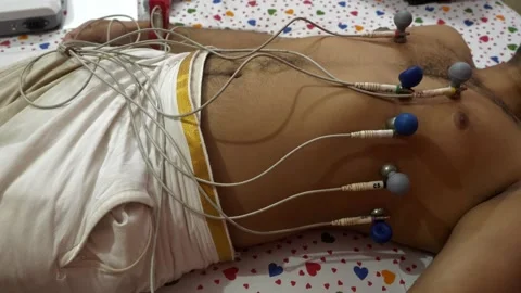 ECG machine electrodes attached to patient's chest, arms, and legs to record Stock Footage 295746405