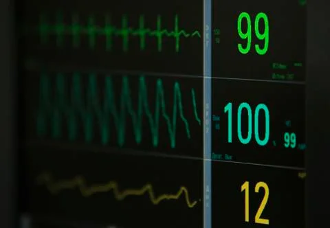 ECG monitor's data Stockfoto's