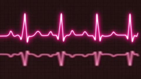 ECG or EKG graph, Cardiogram heartbeat heat pulse glowing red neon light lo.. Stock Footage 246794108