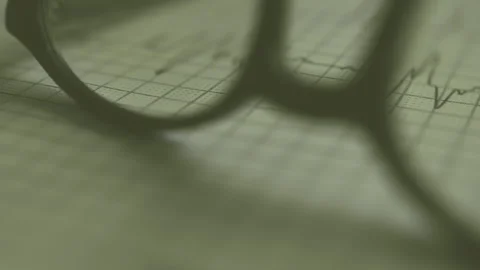 ECG or EKG Report Chart and Reading Glasses VPB Couple diagnose (close-up) Video stock 275438549