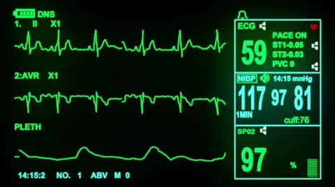 Ecg screen Stock Footage 24160944