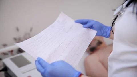 ECG sinus rhythm, examination report, doctor analyzes the cardiogram Stock Footage 279627041