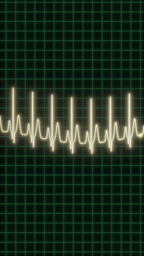 ECG vertical fitness 150bpm loop Stock Footage 346395967