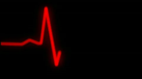Ecg wave on the ecg monitor in red Stock Footage