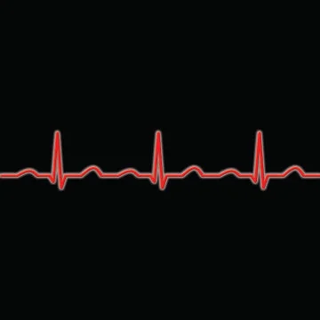 Ecg waves in red on a black background Stock Illustration