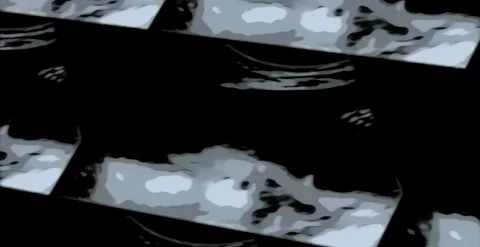 Echo-CMB11 Stock Footage 320966258