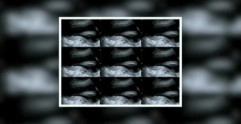ECHO-PR13 Stock Footage 320966188