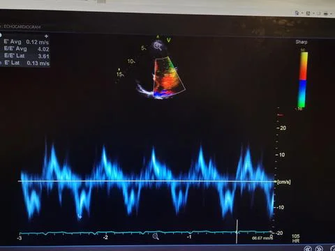 Echocardiogram colorful probe targeting map and waveforms Stock Photos