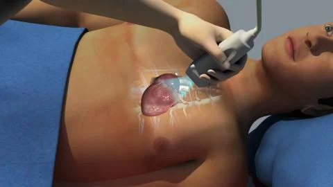 Echocardiogram Stock Illustration