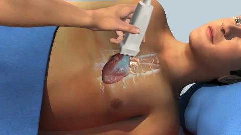 Echocardiogram Stock Illustration