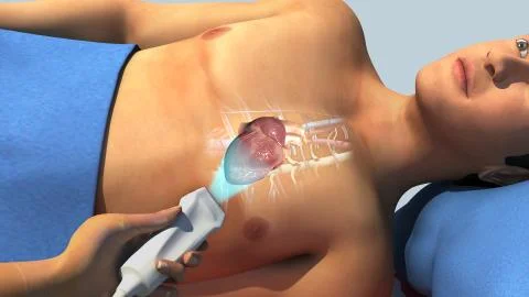 Echocardiogram Stock Illustration