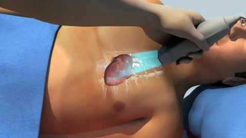 Echocardiogram Stock Illustration