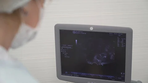 Echogram Vidéo 127708924